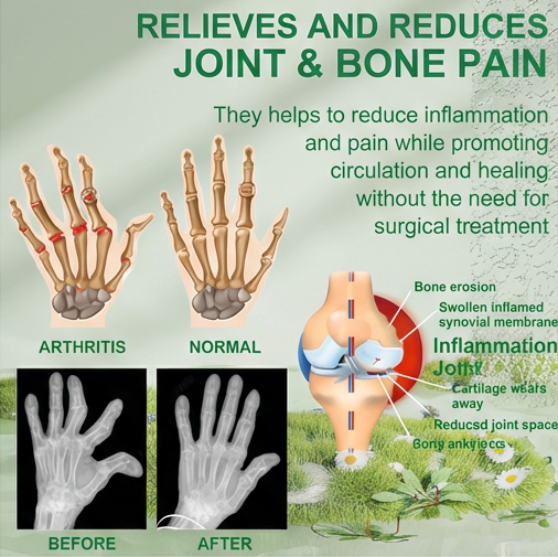 Bee Venom Joint and Bone Therapy Cream (Pack of 3)